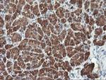 MLF1 Antibody in Immunohistochemistry (Paraffin) (IHC (P))