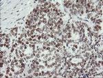 MLF1 Antibody in Immunohistochemistry (Paraffin) (IHC (P))