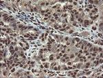 MPI Antibody in Immunohistochemistry (Paraffin) (IHC (P))