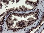 MPI Antibody in Immunohistochemistry (Paraffin) (IHC (P))