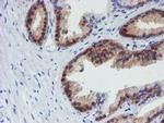 MPI Antibody in Immunohistochemistry (Paraffin) (IHC (P))