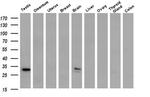 Syntenin 1 Antibody in Western Blot (WB)