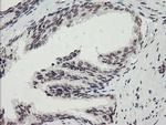 MLF2 Antibody in Immunohistochemistry (Paraffin) (IHC (P))