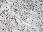 MLF2 Antibody in Immunohistochemistry (Paraffin) (IHC (P))