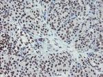 MLF2 Antibody in Immunohistochemistry (Paraffin) (IHC (P))