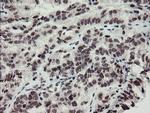 MLF2 Antibody in Immunohistochemistry (Paraffin) (IHC (P))