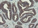 DPH2 Antibody in Immunohistochemistry (Paraffin) (IHC (P))