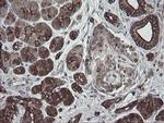 DPH2 Antibody in Immunohistochemistry (Paraffin) (IHC (P))