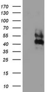 LRRC25 Monoclonal Antibody (OTI1C5)