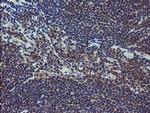 COMMD1 Monoclonal Antibody (OTI2E2)