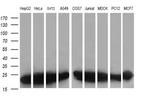 VBP1 Antibody in Western Blot (WB)