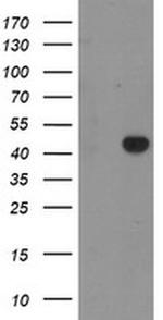 RAB3IL1 Monoclonal Antibody (OTI1B5)