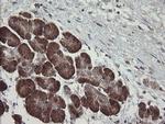 TPD52L3 Antibody in Immunohistochemistry (Paraffin) (IHC (P))