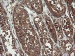 TPD52L3 Antibody in Immunohistochemistry (Paraffin) (IHC (P))