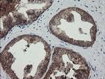 TPD52L3 Antibody in Immunohistochemistry (Paraffin) (IHC (P))