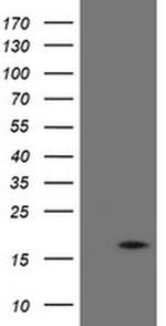 TPD52L3 Antibody in Western Blot (WB)