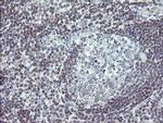 TPD52L3 Antibody in Immunohistochemistry (Paraffin) (IHC (P))