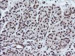 TPD52L3 Antibody in Immunohistochemistry (Paraffin) (IHC (P))