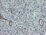 TPD52L3 Antibody in Immunohistochemistry (Paraffin) (IHC (P))