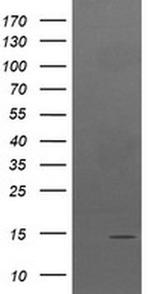 TPD52L3 Antibody in Western Blot (WB)