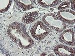 TPD52L3 Antibody in Immunohistochemistry (Paraffin) (IHC (P))