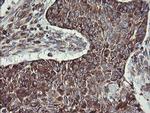 TPD52L3 Antibody in Immunohistochemistry (Paraffin) (IHC (P))