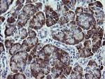 TPD52L3 Antibody in Immunohistochemistry (Paraffin) (IHC (P))