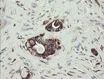 TPD52L3 Antibody in Immunohistochemistry (Paraffin) (IHC (P))