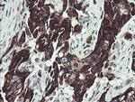TPD52L3 Antibody in Immunohistochemistry (Paraffin) (IHC (P))