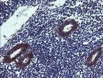 TPD52L3 Antibody in Immunohistochemistry (Paraffin) (IHC (P))