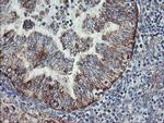 C1orf151 Monoclonal Antibody (OTI4H7)