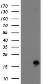TSC22D1 Antibody in Western Blot (WB)