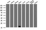 TSC22D1 Antibody in Western Blot (WB)