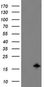 TSC22D1 Antibody in Western Blot (WB)