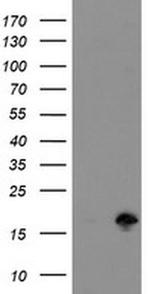 TSC22D1 Antibody in Western Blot (WB)