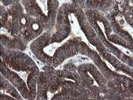GORAB Antibody in Immunohistochemistry (Paraffin) (IHC (P))