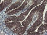 GORAB Antibody in Immunohistochemistry (Paraffin) (IHC (P))