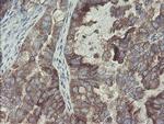 GORAB Antibody in Immunohistochemistry (Paraffin) (IHC (P))