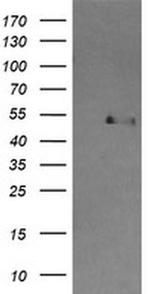 CBLC Antibody in Western Blot (WB)