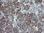 CLEC4E Antibody in Immunohistochemistry (Paraffin) (IHC (P))