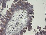 CLEC4E Antibody in Immunohistochemistry (Paraffin) (IHC (P))