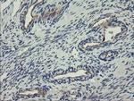 CLEC4E Antibody in Immunohistochemistry (Paraffin) (IHC (P))