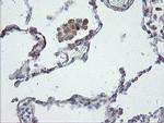 CHN1 Antibody in Immunohistochemistry (Paraffin) (IHC (P))