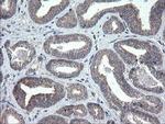 CHN1 Antibody in Immunohistochemistry (Paraffin) (IHC (P))