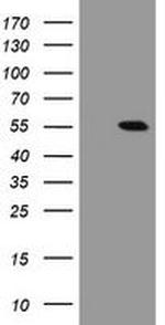 CHN1 Antibody in Western Blot (WB)