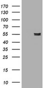 alpha Amylase 2B Antibody in Western Blot (WB)