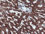 NDUFB10 Antibody in Immunohistochemistry (Paraffin) (IHC (P))