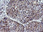 NDUFB10 Antibody in Immunohistochemistry (Paraffin) (IHC (P))