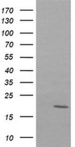 NDUFB10 Antibody in Western Blot (WB)