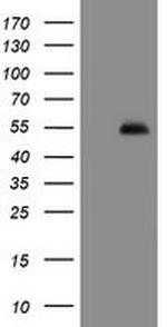 PHF7 Antibody in Western Blot (WB)